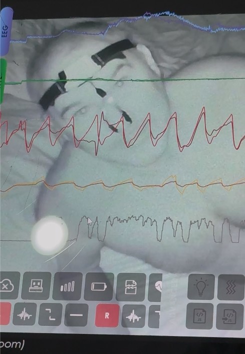 ZMax EEG headband — live brainwaves, 2026